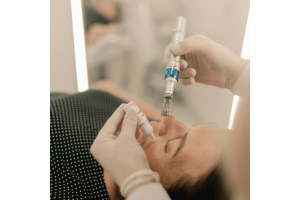 Damage-Free Microneedling| How to Give Clients the Best Results
